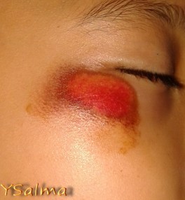 Akibat Bercanda Kelewatan