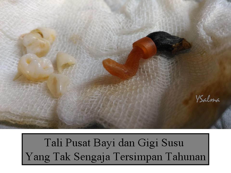 Tali pusar bayi dan gigi susu tersimpan untuk kenangan