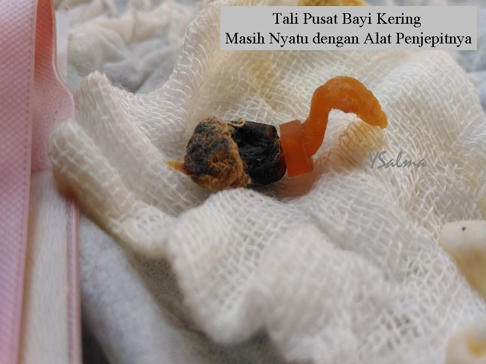 Tali pusat bayi puput kering