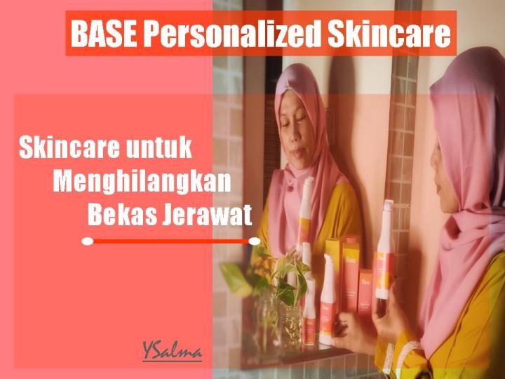 Skincare untuk menghilangkan jerawat Base Personalized Skincare