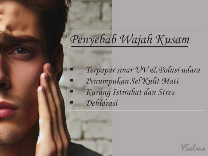cara agar wajah tidak kusam dan penyebabnya